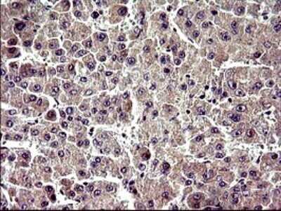 Immunohistochemistry: ZNF365 Antibody (OTI9H5) - Azide and BSA Free [NBP2-74939]