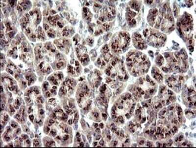 Immunohistochemistry: ZNF365 Antibody (OTI9H5) - Azide and BSA Free [NBP2-74939]