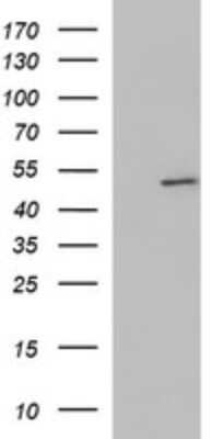 Western Blot: ZNF365 Antibody (OTI9H5)Azide and BSA Free [NBP2-74939]