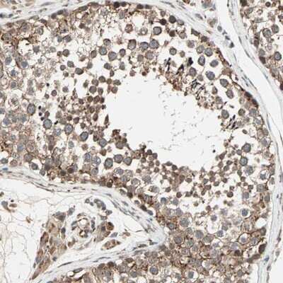 Immunohistochemistry-Paraffin: ZNF37A Antibody [NBP1-81345]