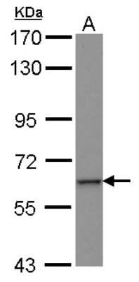 Western Blot: ZNF37A Antibody [NBP2-21001]