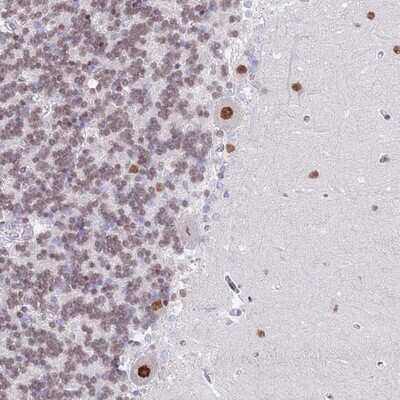 Immunohistochemistry-Paraffin: ZNF382 Antibody [NBP2-13569]