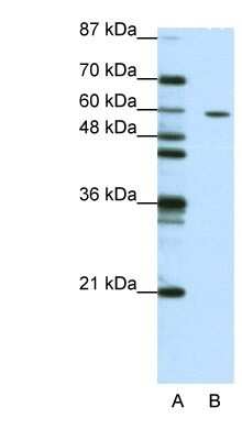 Western Blot: ZNF382 Antibody [NBP1-80380]