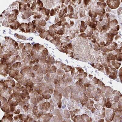Immunohistochemistry-Paraffin: ZNF383 Antibody [NBP2-38034]