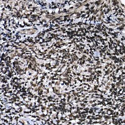 Immunohistochemistry-Paraffin: ZNF384 Antibody - Azide and BSA Free [NBP2-94454]