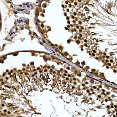 Immunohistochemistry-Paraffin: ZNF384 Antibody - Azide and BSA Free [NBP2-94454]