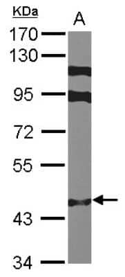 Western Blot: ZNF384 Antibody [NBP2-21002]