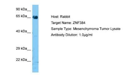 Western Blot: ZNF384 Antibody [NBP2-86482]