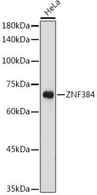 Western Blot: ZNF384 AntibodyAzide and BSA Free [NBP2-94454]