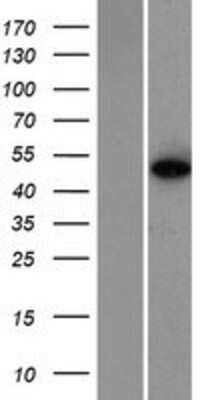 Western Blot: ZNF384 Overexpression Lysate [NBP2-08536]