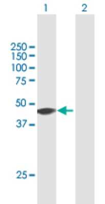 Western Blot: ZNF385 Antibody [H00025946-B01P]