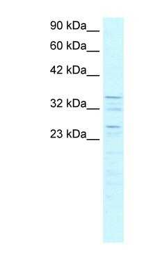 Western Blot: ZNF385 Antibody [NBP1-79983]