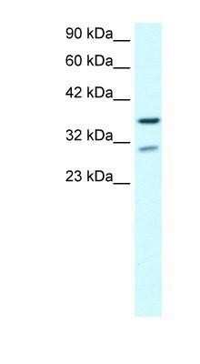 Western Blot: ZNF385 Antibody [NBP1-80004]