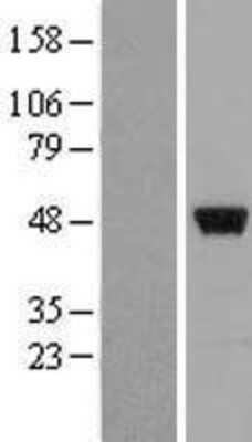 Western Blot: ZNF385 Overexpression Lysate [NBL1-18135]