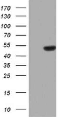 Western Blot: ZNF385B Antibody (OTI1H10) [NBP2-46445]