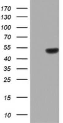 Western Blot: ZNF385B Antibody (OTI1H10)Azide and BSA Free [NBP2-74948]