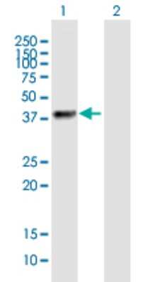 Western Blot: ZNF385B Antibody [H00151126-B01P]