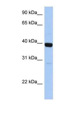 Western Blot: ZNF385B Antibody [NBP1-79420]