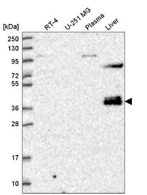 Western Blot: ZNF385B Antibody [NBP2-58807]