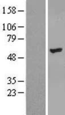 Western Blot: ZNF385B Overexpression Lysate [NBL1-18136]