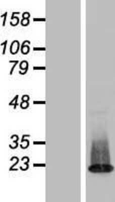 Western Blot: ZNF385C Overexpression Lysate [NBL1-18137]