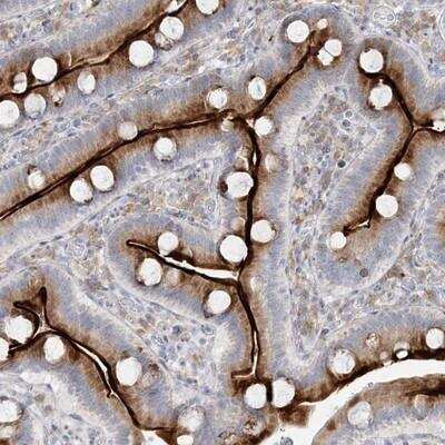 Immunohistochemistry-Paraffin: ZNF385D Antibody [NBP1-82121]