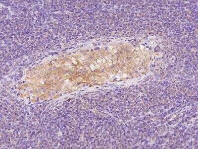 Immunohistochemistry-Paraffin: ZNF385D Antibody [NBP3-05996]