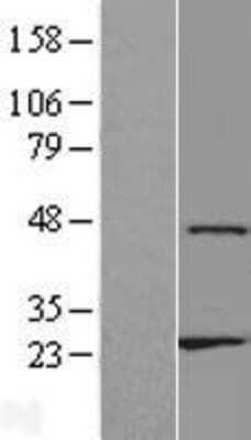 Western Blot: ZNF385D Overexpression Lysate [NBL1-18138]