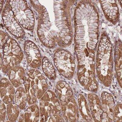 Immunohistochemistry-Paraffin: ZNF391 Antibody [NBP2-14715]