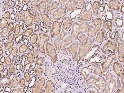 Immunohistochemistry-Paraffin: ZNF391 Antibody [NBP2-98020]