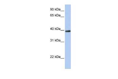 Western Blot: ZNF391 Antibody [NBP2-86486]