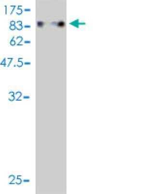 Western Blot: ZNF394 Antibody (1D9) [H00084124-M01]