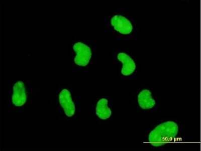 Immunocytochemistry/ Immunofluorescence: ZNF394 Antibody (1F8) [H00084124-M03]