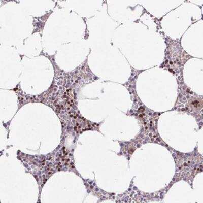 Immunohistochemistry: ZNF394 Antibody [NBP2-30743]