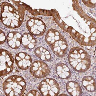 Immunohistochemistry: ZNF394 Antibody [NBP2-30811]