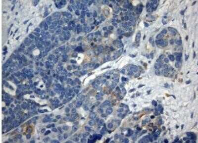 Immunohistochemistry: ZNF394 Antibody (OTI1G9) - Azide and BSA Free [NBP2-74949]