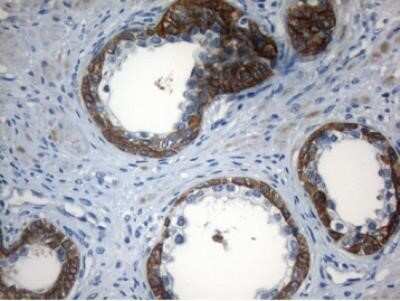 Immunohistochemistry: ZNF394 Antibody (OTI1G9) - Azide and BSA Free [NBP2-74949]