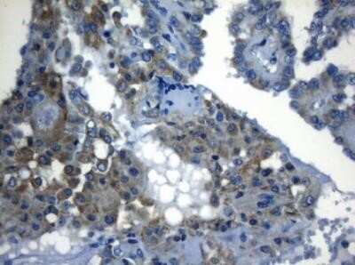 Immunohistochemistry: ZNF394 Antibody (OTI1G9) - Azide and BSA Free [NBP2-74949]