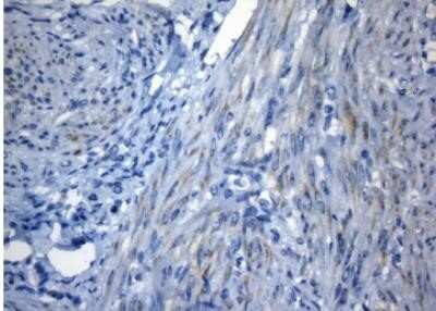 Immunohistochemistry: ZNF394 Antibody (OTI1G9) - Azide and BSA Free [NBP2-74949]