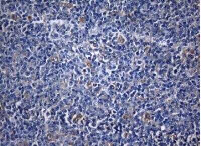 Immunohistochemistry: ZNF394 Antibody (OTI1G9) - Azide and BSA Free [NBP2-74949]