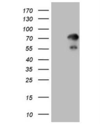 Western Blot: ZNF394 Antibody (OTI1G9)Azide and BSA Free [NBP2-74949]