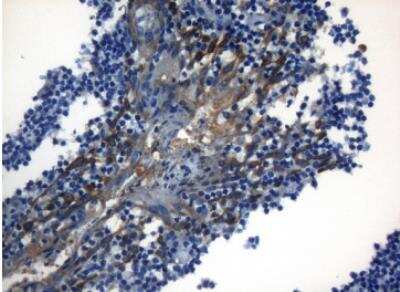 Immunohistochemistry-Paraffin: ZNF394 Antibody (OTI1G9) [NBP2-46446]
