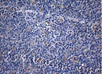 Immunohistochemistry-Paraffin: ZNF394 Antibody (OTI1G9) [NBP2-46446]