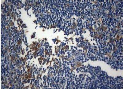 Immunohistochemistry-Paraffin: ZNF394 Antibody (OTI1G9) [NBP2-46446]
