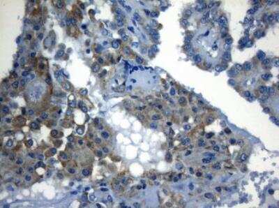 Immunohistochemistry-Paraffin: ZNF394 Antibody (OTI1G9) [NBP2-46446]