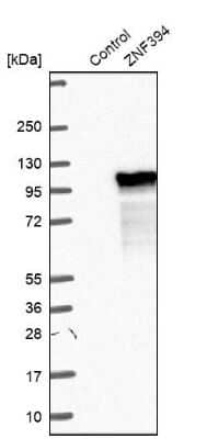 Western Blot: ZNF394 Antibody [NBP2-30743]