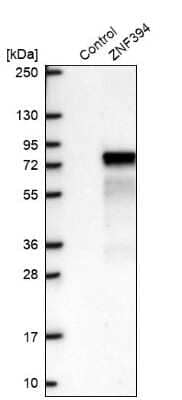 Western Blot: ZNF394 Antibody [NBP2-30811]