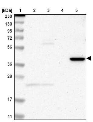 Western Blot: ZNF396 Antibody [NBP1-82025]