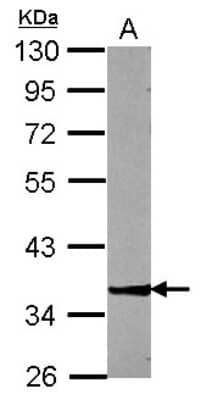 Western Blot: ZNF396 Antibody [NBP2-21003]