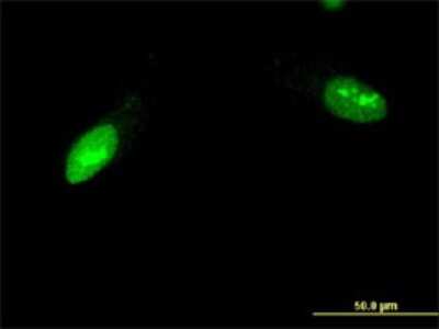 Immunocytochemistry/ Immunofluorescence: ZNF397 Antibody (1F8) [H00084307-M02]